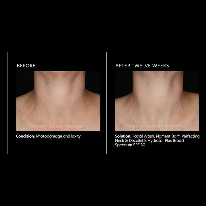 PCA Perfecting Neck and Décolleté PCA Skin