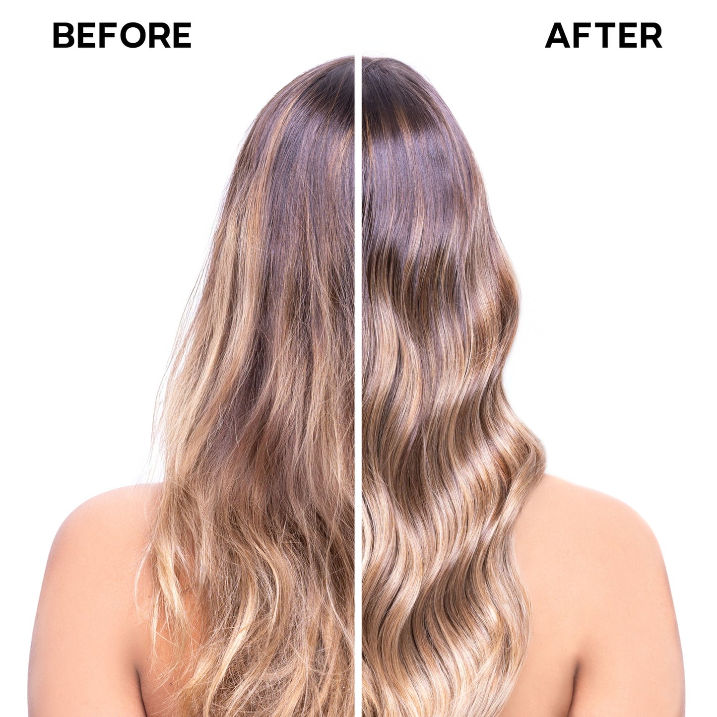 After-Sun Treatment