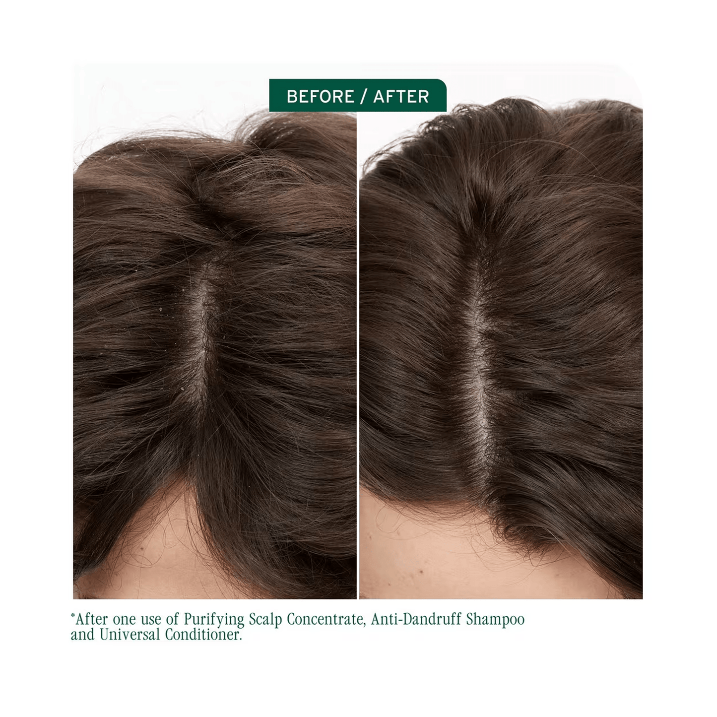 Biolage Scalp Sync Anti - Dandruff Shampoo & Scalp Sync Universal Conditioner Liter Duo ($90 Value) - Beautifox