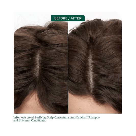 Biolage Scalp Sync Anti - Dandruff Shampoo & Scalp Sync Universal Conditioner Liter Duo ($90 Value) - Beautifox
