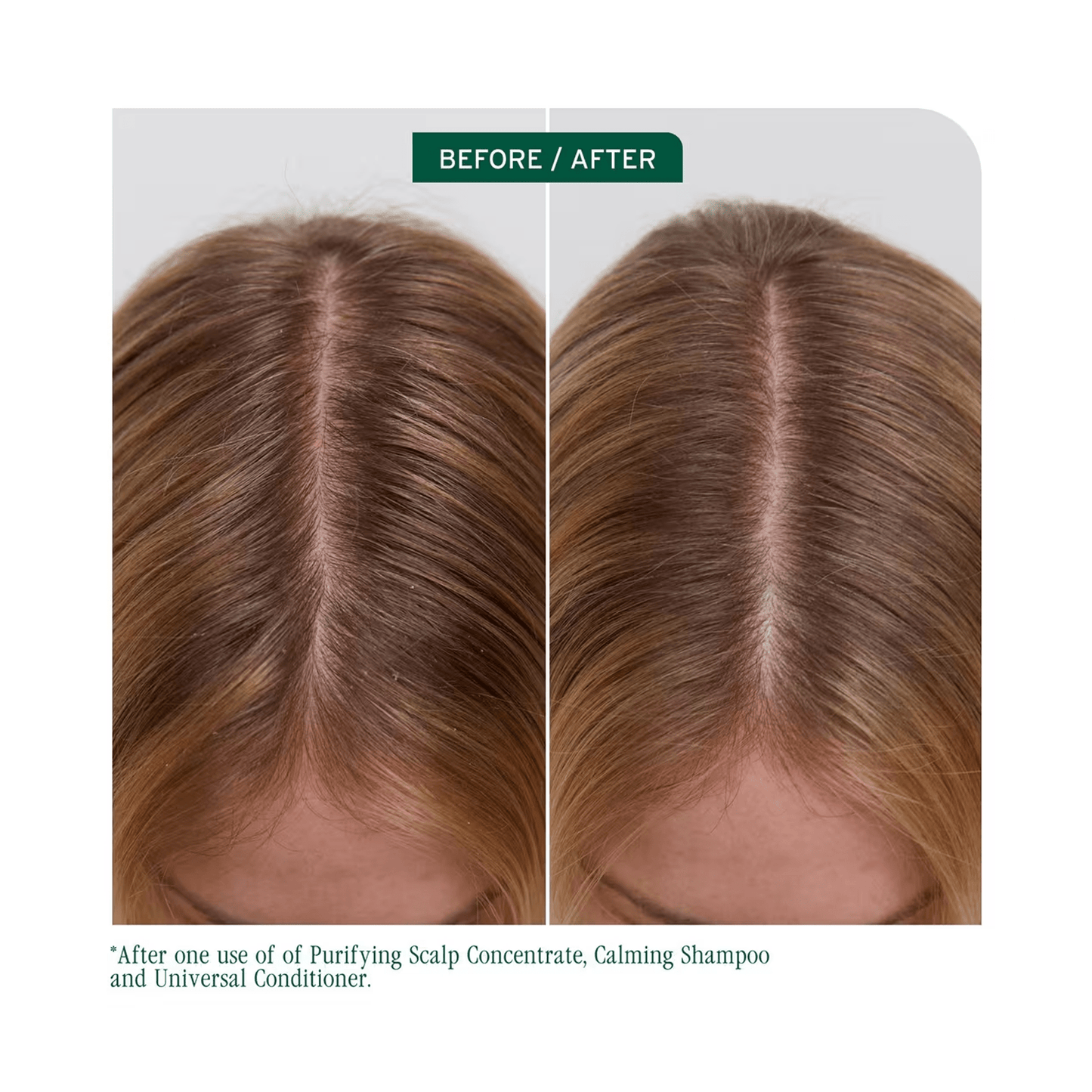 Biolage Scalp Sync Calming Shampoo - Beautifox