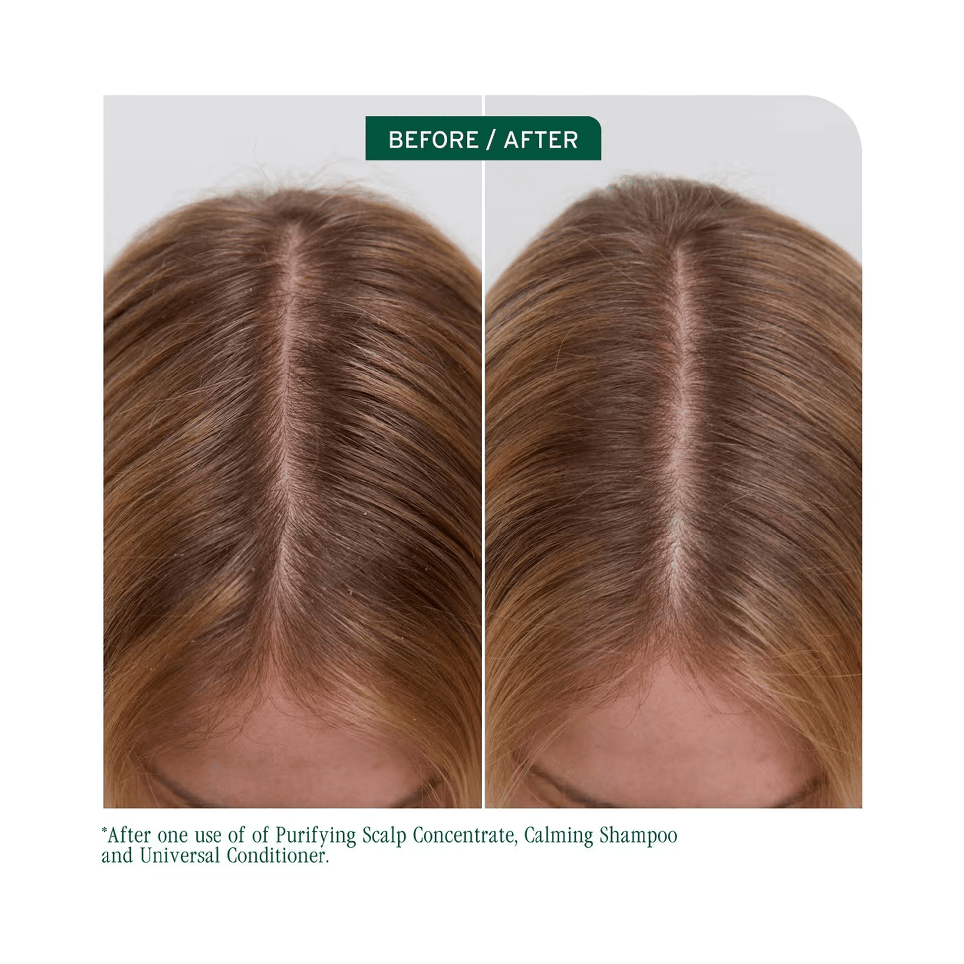 Biolage Scalp Sync Calming Shampoo & Scalp Sync Universal Conditioner Liter Duo ($90 Value) - Beautifox