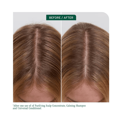 Biolage Scalp Sync Calming Shampoo & Scalp Sync Universal Conditioner Liter Duo ($90 Value) - Beautifox