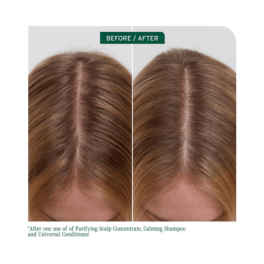 Biolage Scalp Sync Calming Shampoo & Scalp Sync Universal Conditioner Liter Duo ($90 Value) - Beautifox