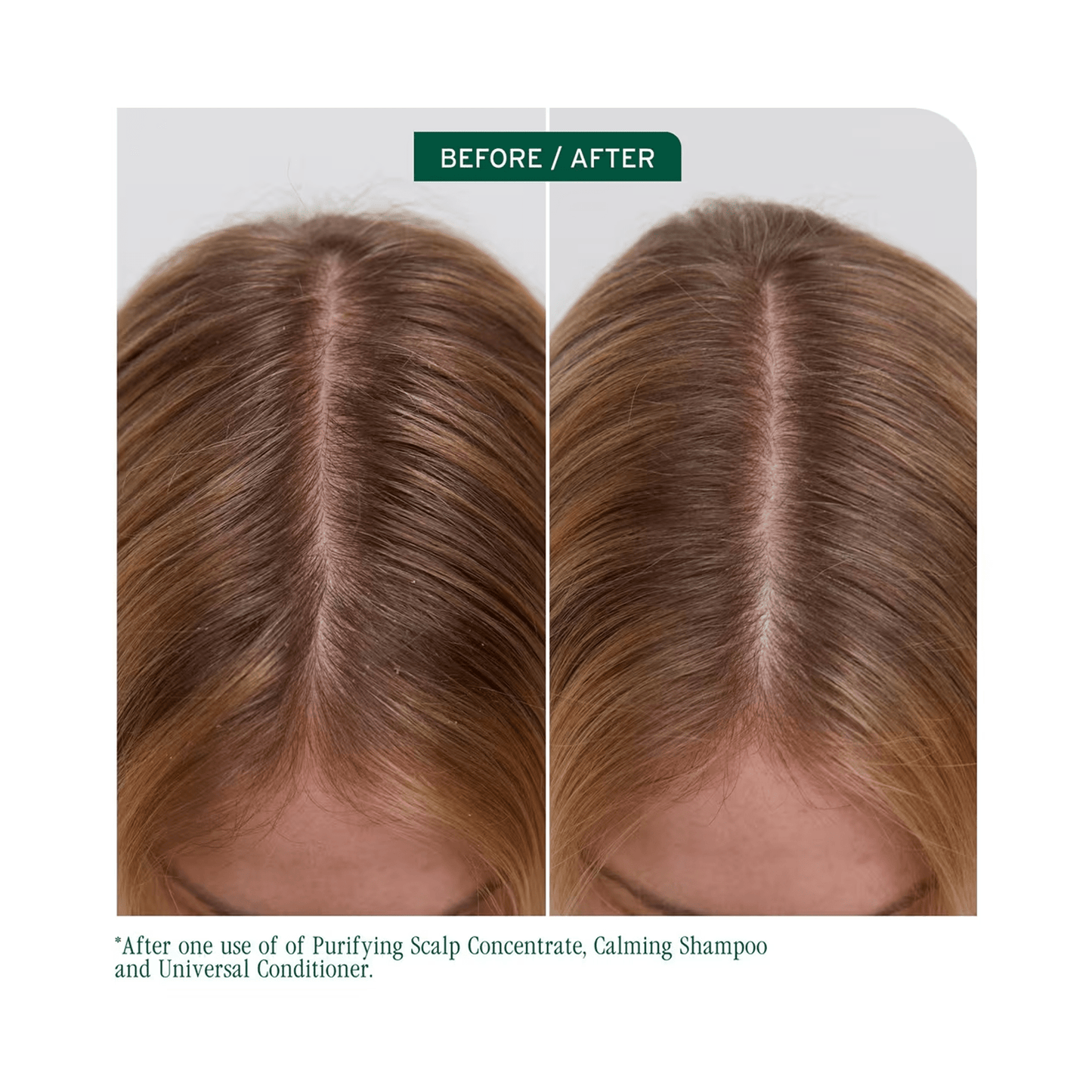 Biolage Scalp Sync Universal Conditioner - Beautifox