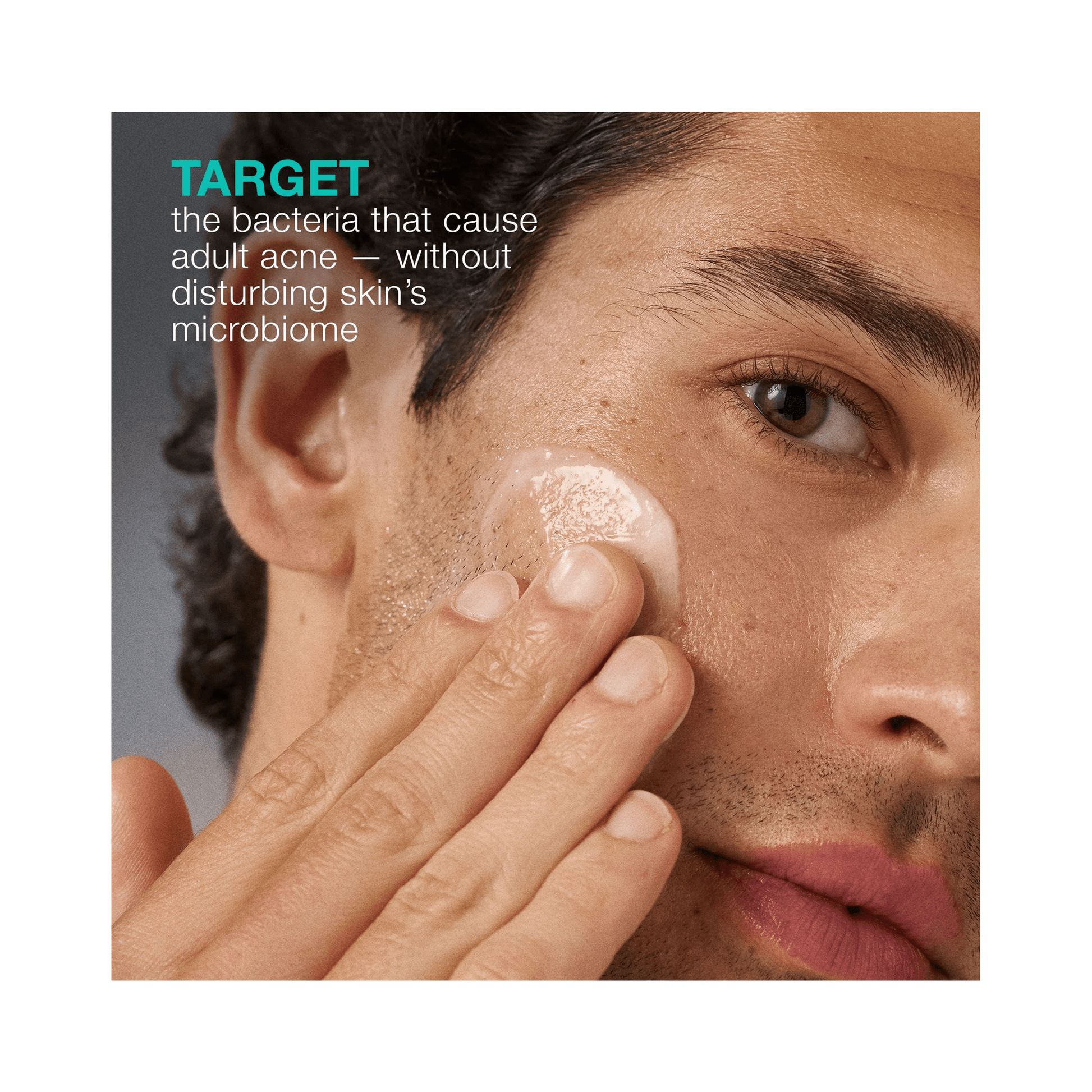 Dermalogica Acne Biotic Moisturizer - Beautifox