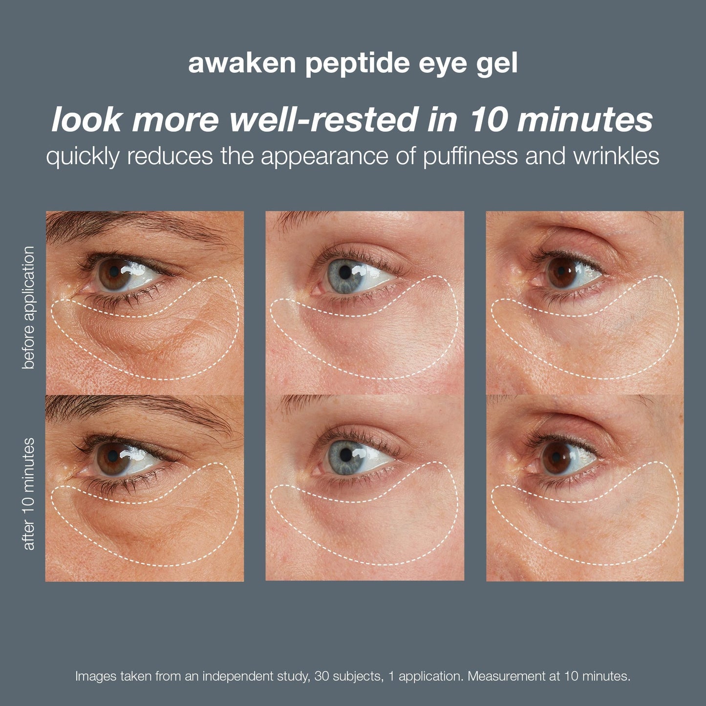 Dermalogica Awaken Peptide Eye Gel - Beautifox