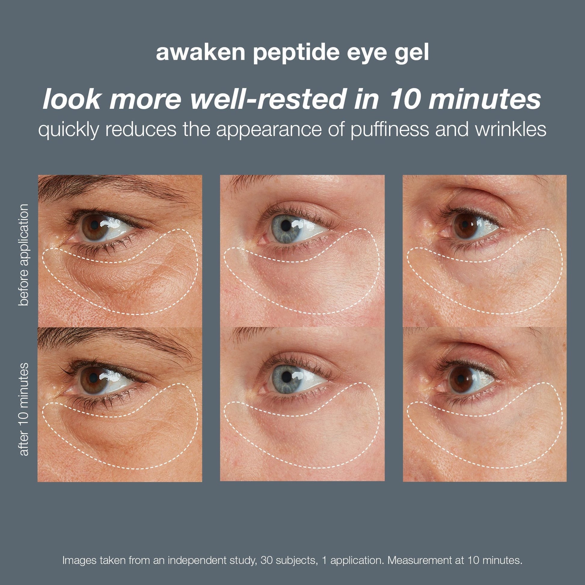 Dermalogica Awaken Peptide Eye Gel - Beautifox
