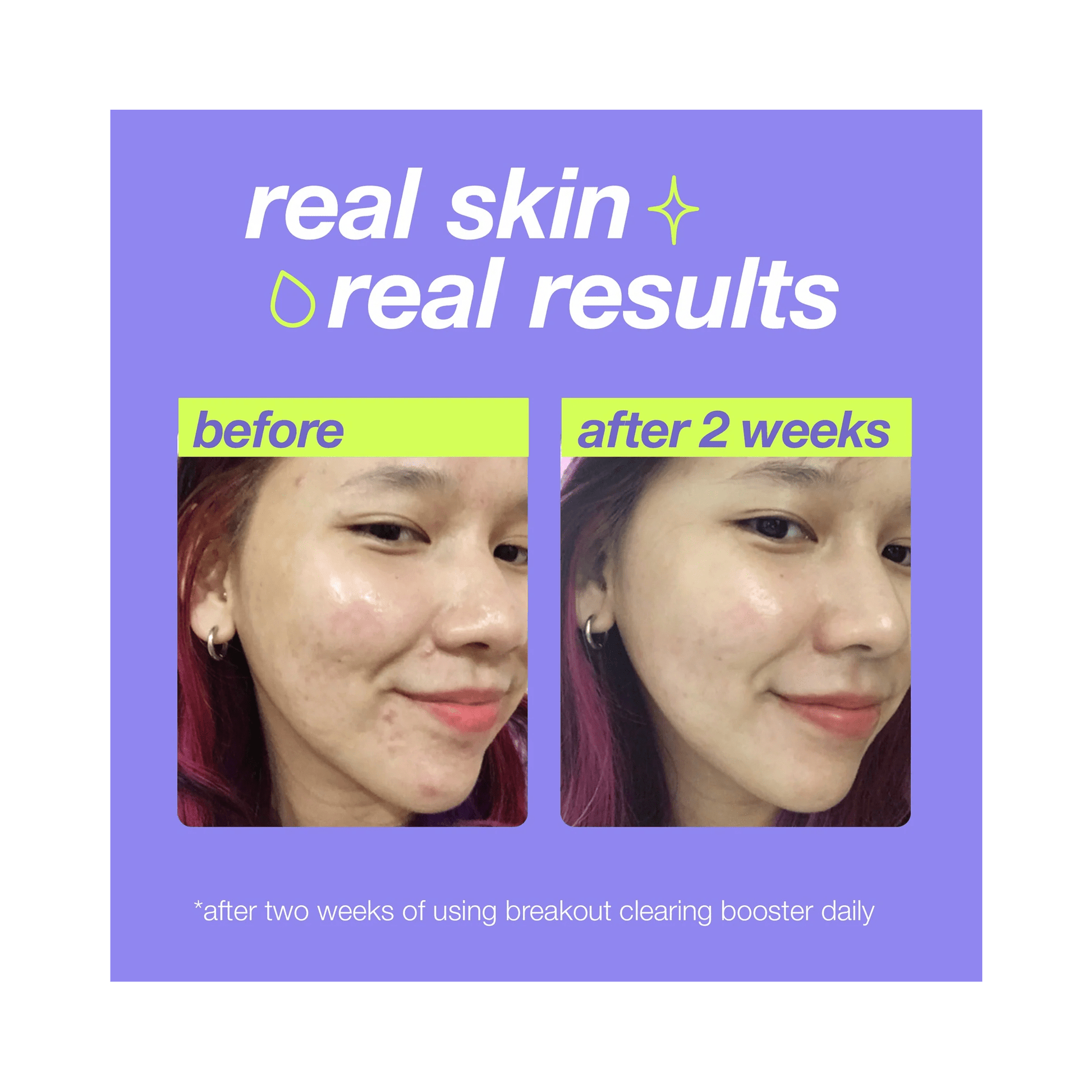 Dermalogica Clear Start Breakout Clearing Booster - Beautifox