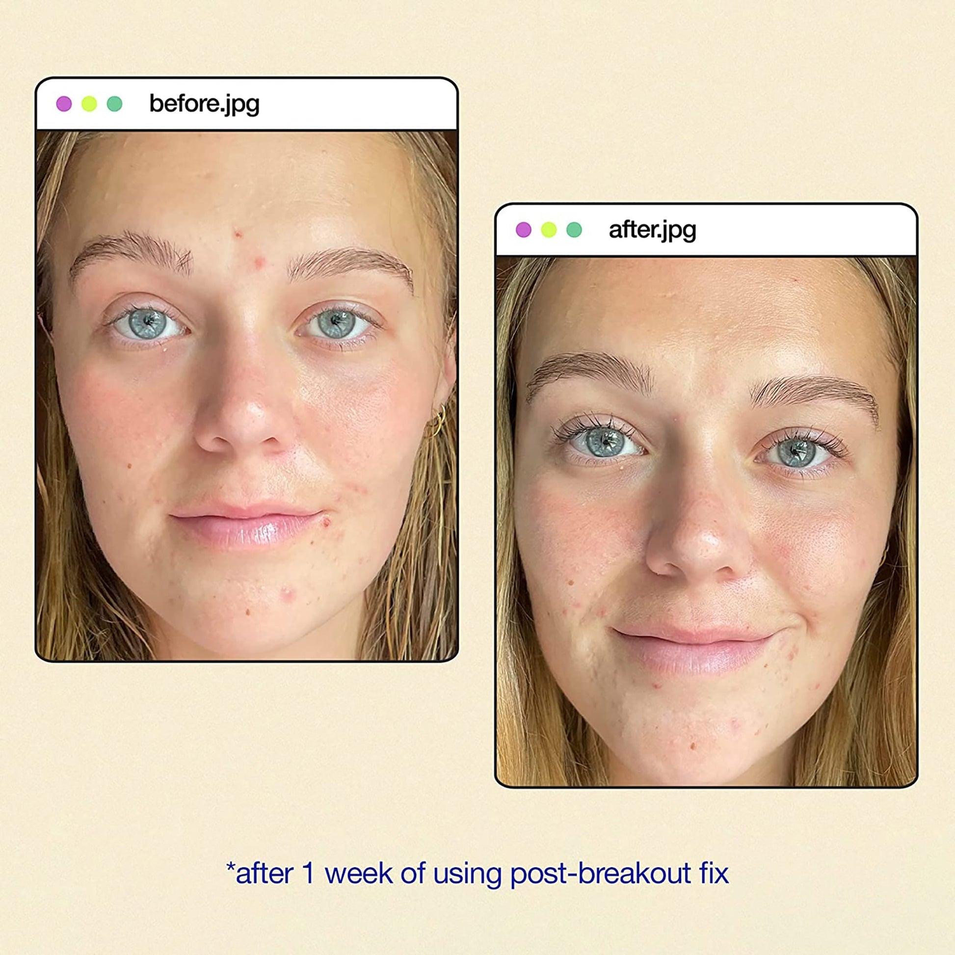 Dermalogica Clear Start Post Breakout Fix - Beautifox