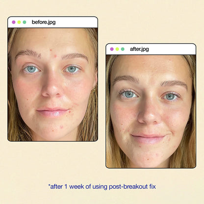 Dermalogica Clear Start Post Breakout Fix - Beautifox