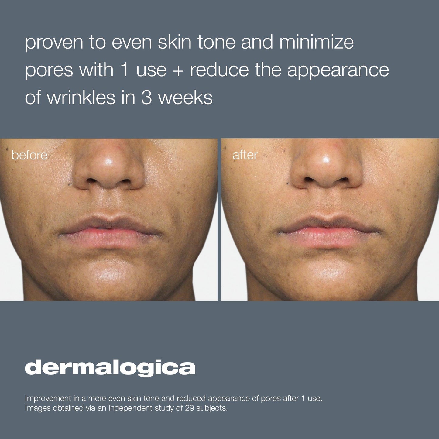 Dermalogica Liquid Peelfoliant - Beautifox