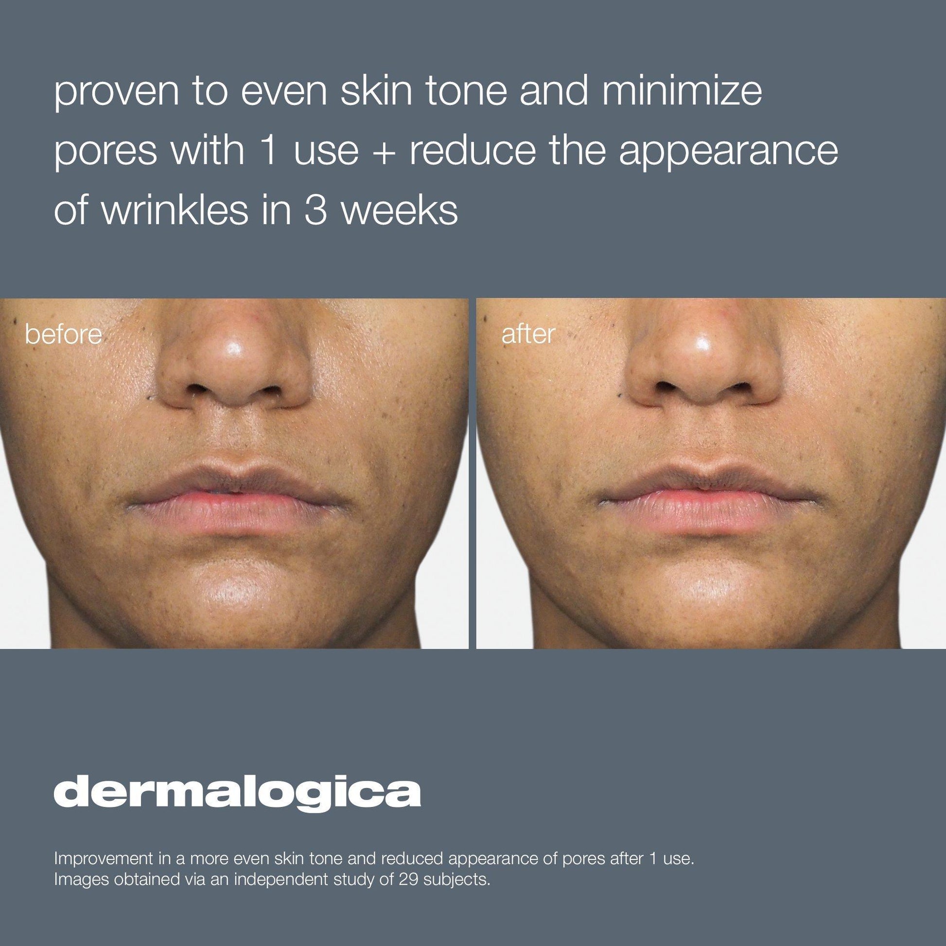 Dermalogica Liquid Peelfoliant - Beautifox