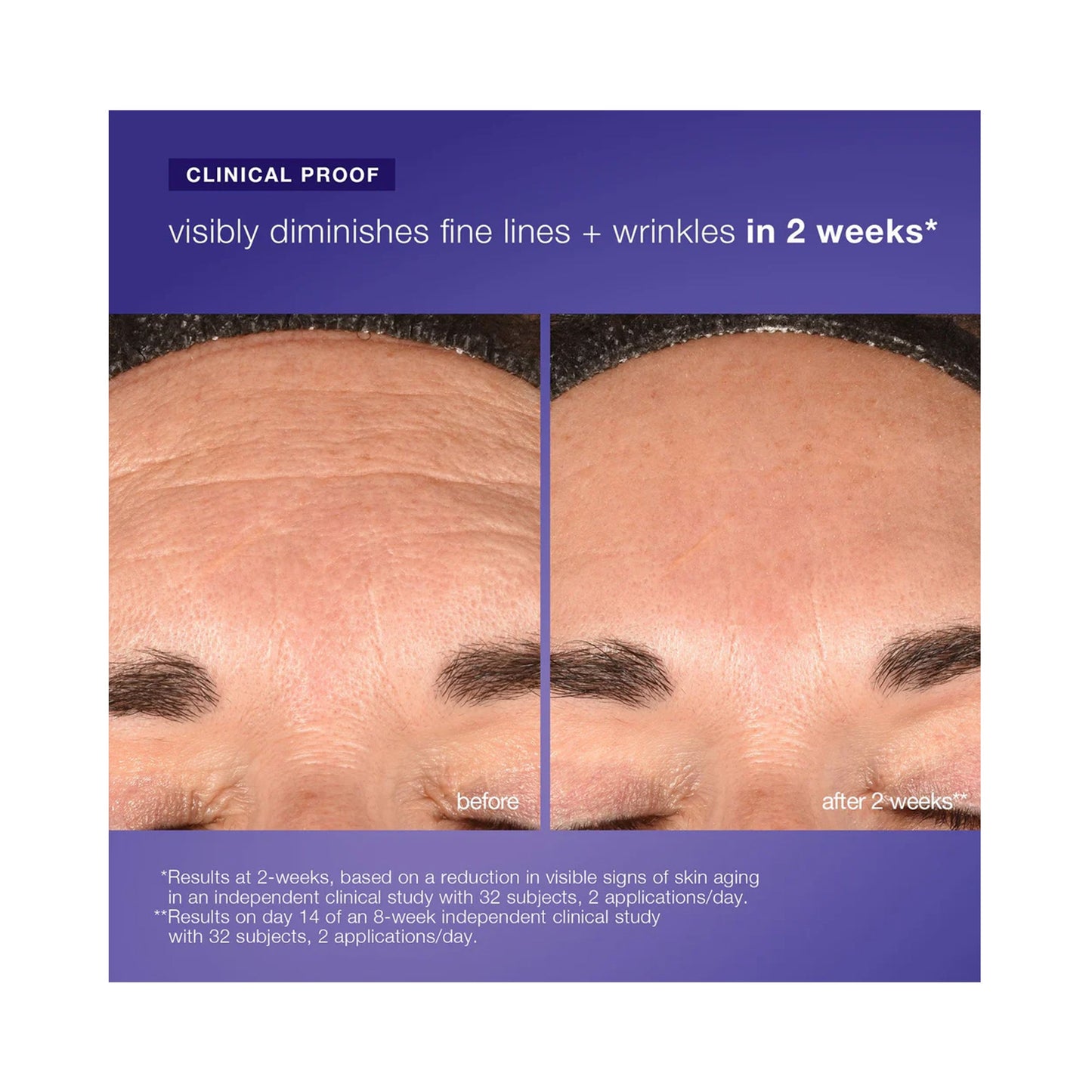 Dermalogica Phyto Nature e² Regenerating Daily Exosome Leave - On Treatment - Beautifox