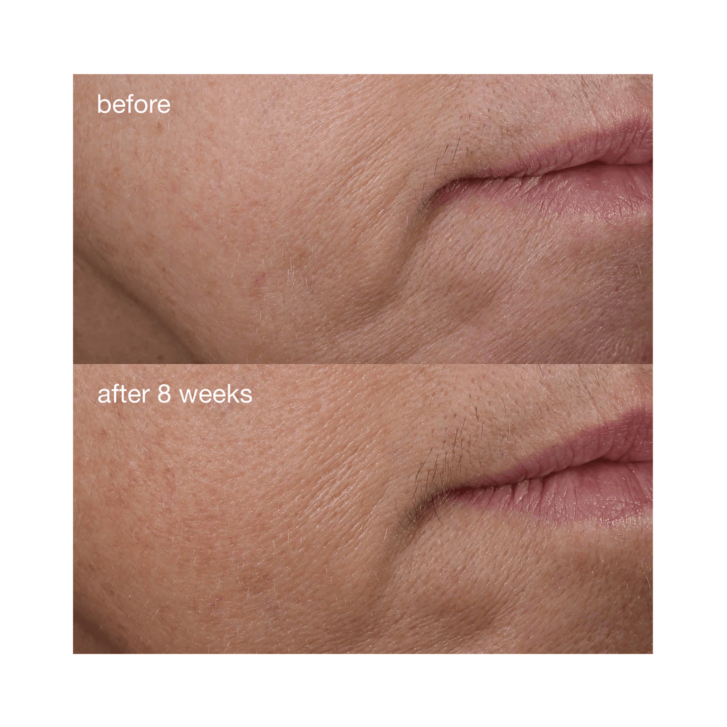 Dermalogica Phyto - Nature Firming Serum - Beautifox