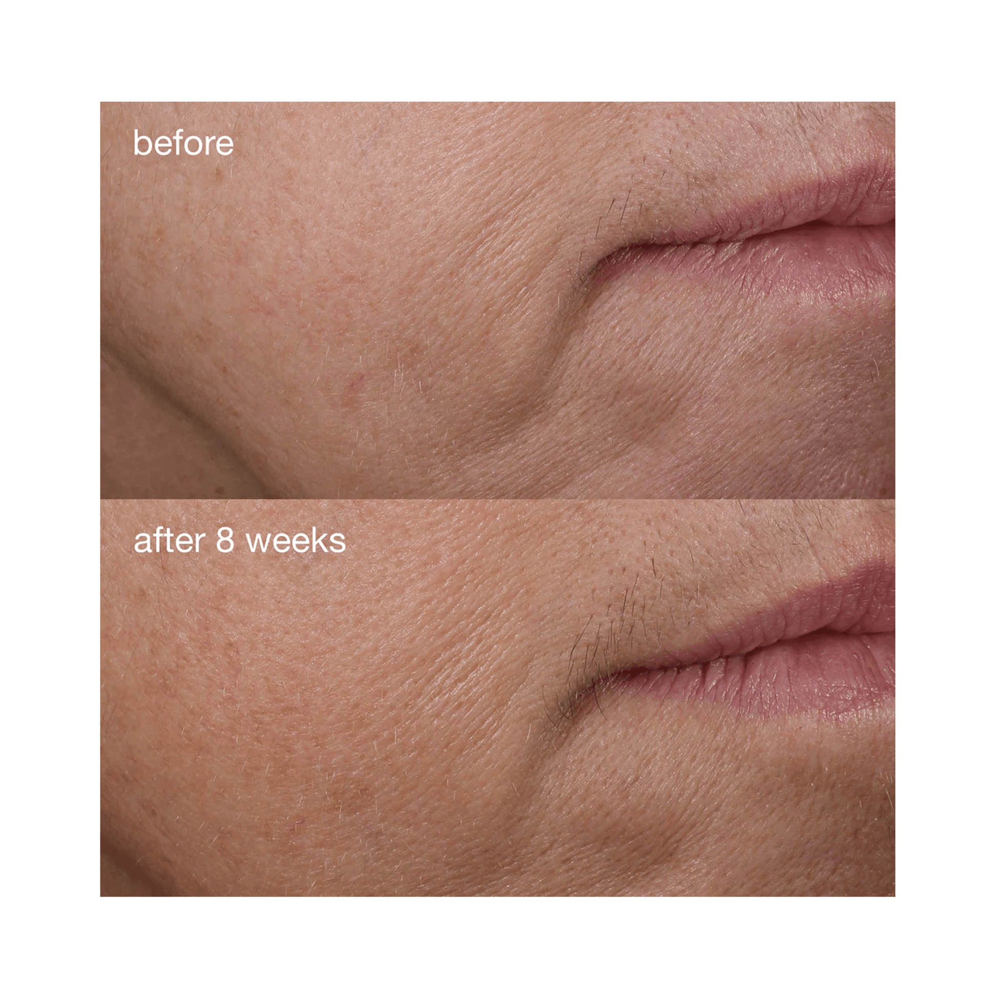 Dermalogica Phyto - Nature Firming Serum - Beautifox