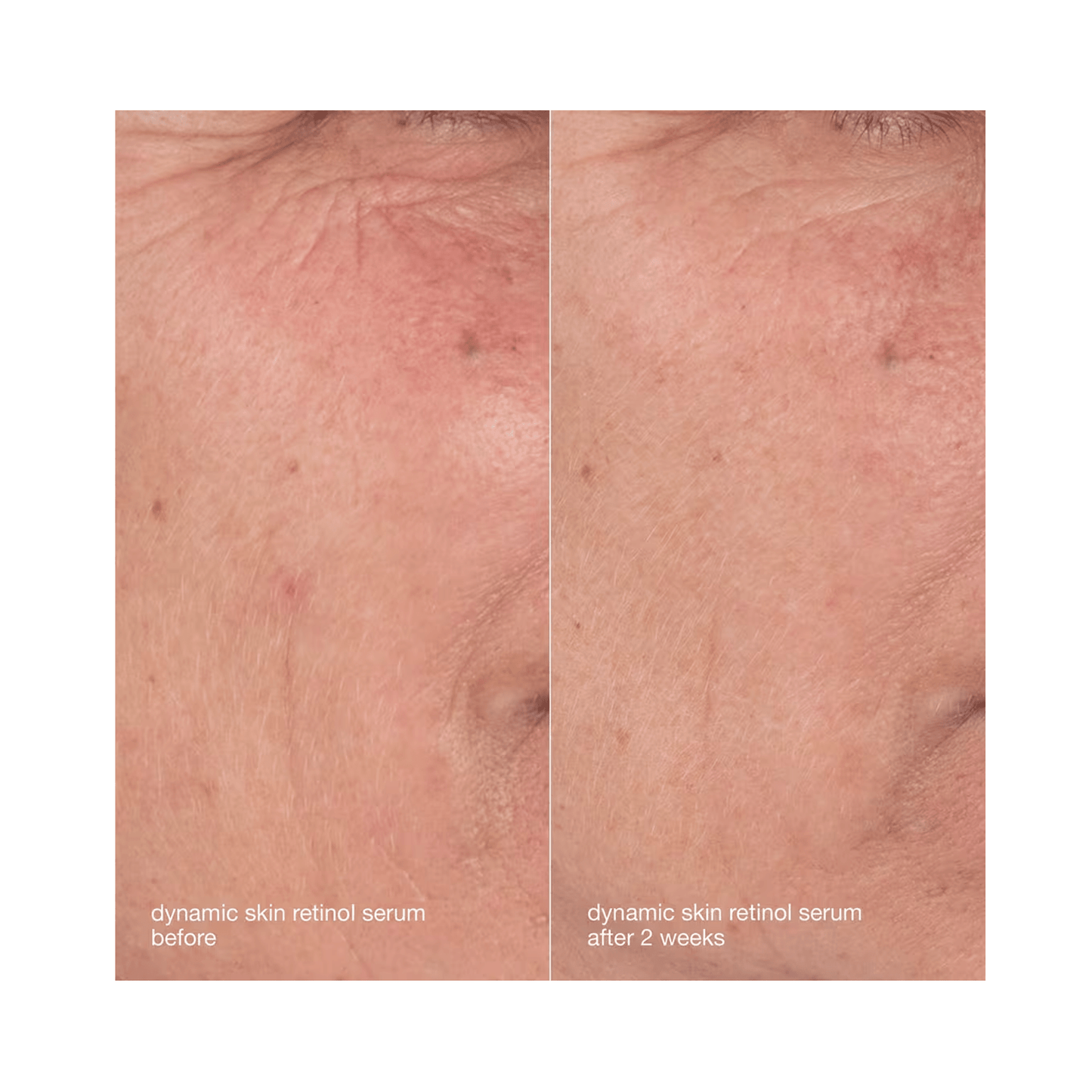 Dermalogica Skin Aging Solutions Kit - Beautifox