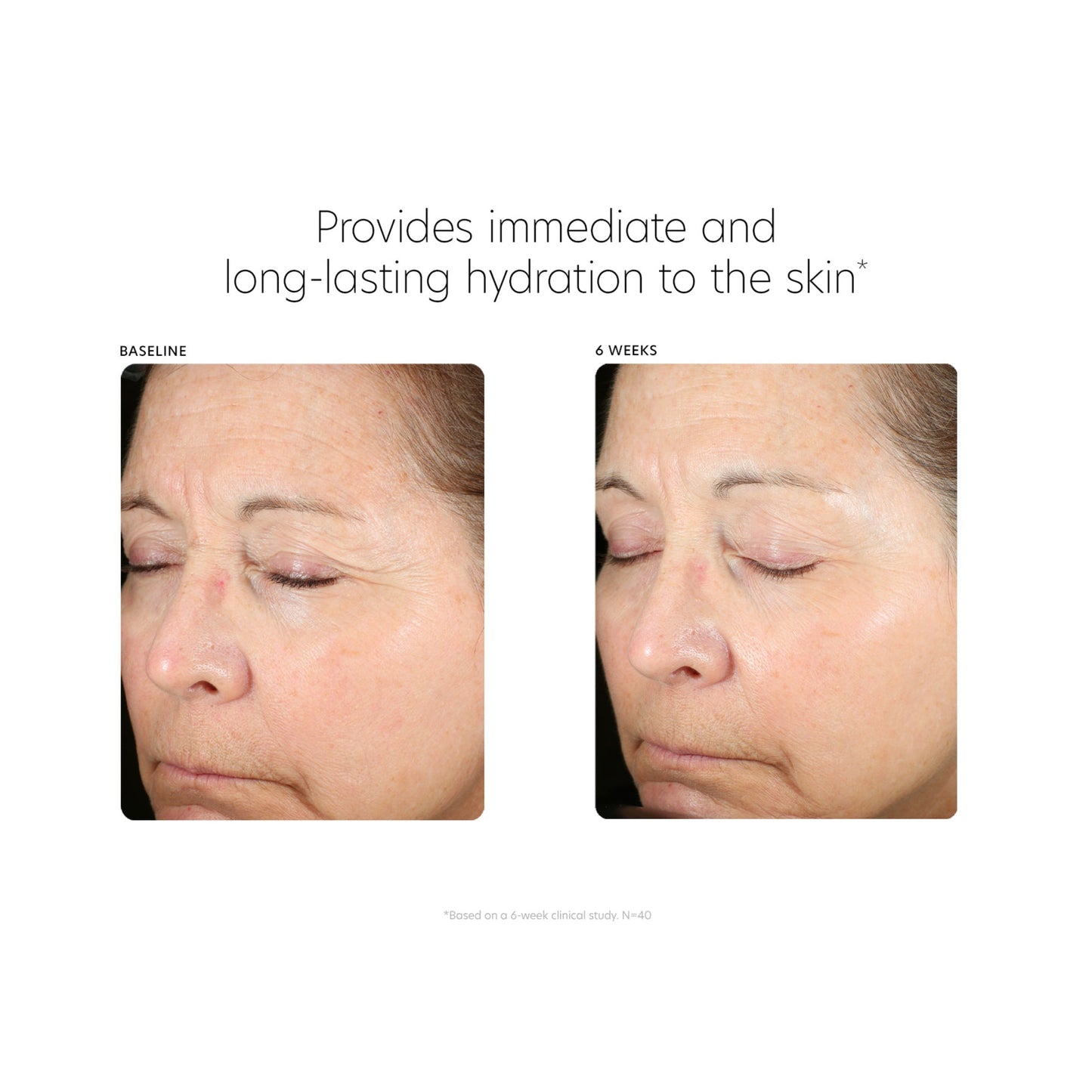 Hyaluronic Acid Boosting Serum - Beautifox