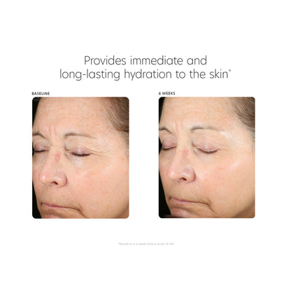 Hyaluronic Acid Boosting Serum - Beautifox