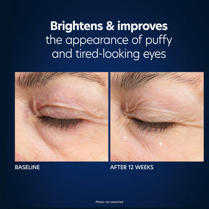 Hyaluronic Acid Microneedle Eye Patches - Beautifox