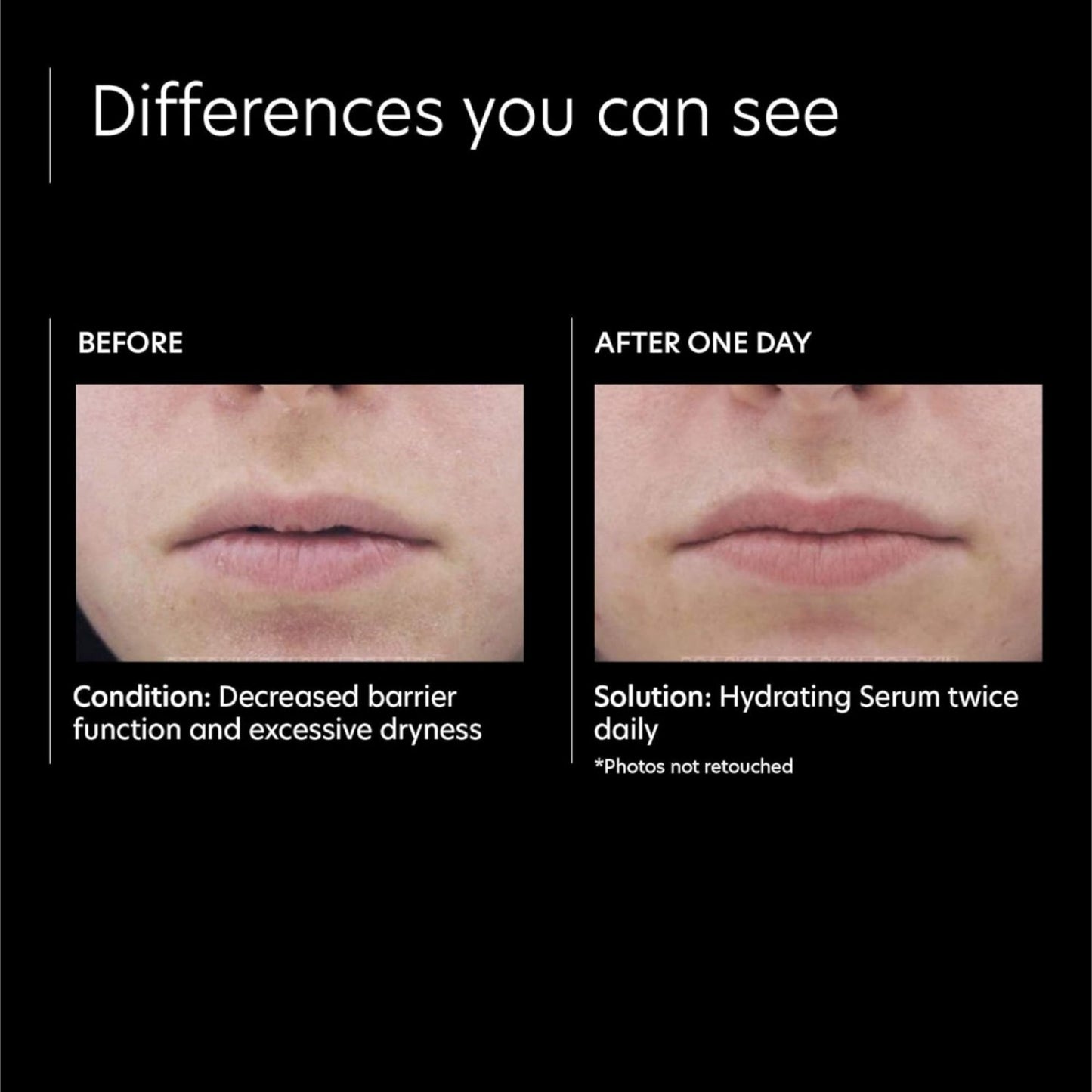 Hydrating Serum - Beautifox