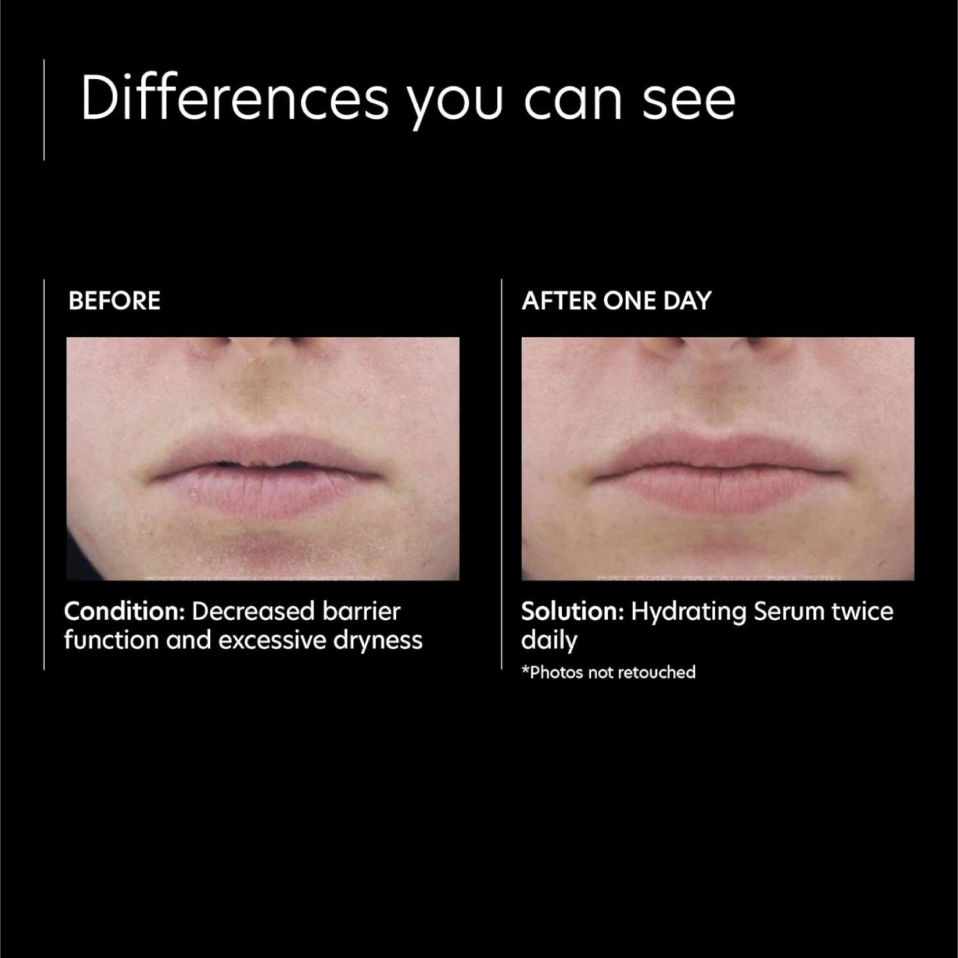Hydrating Serum - Beautifox