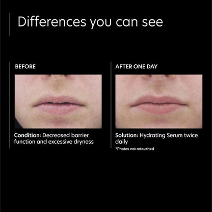 Hydrating Serum - Beautifox