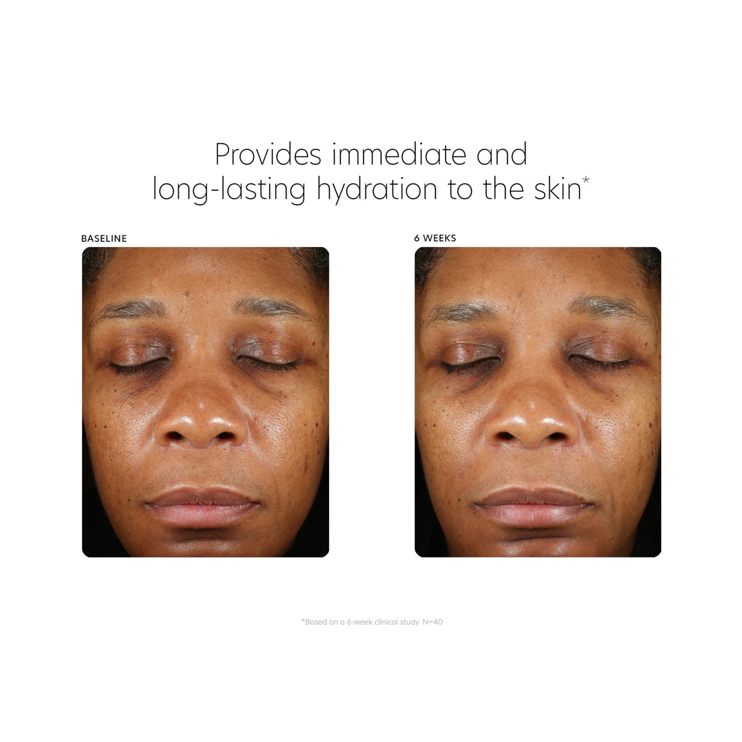 ﻿The Deep Hydration Foundation - Beautifox