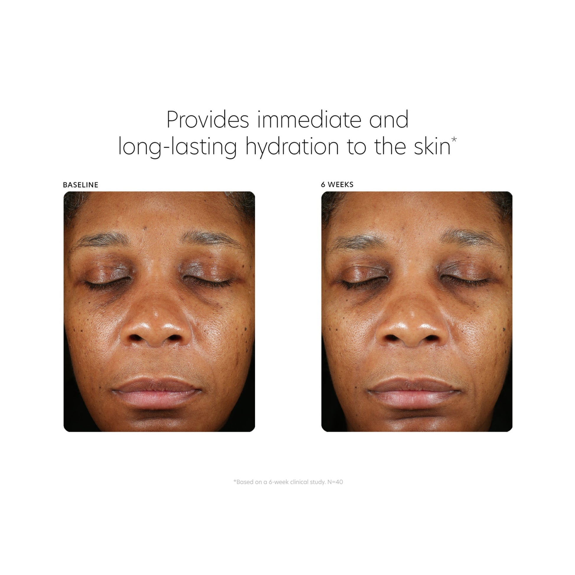 ﻿The Deep Hydration Foundation - Beautifox