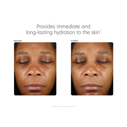 ﻿The Deep Hydration Foundation - Beautifox