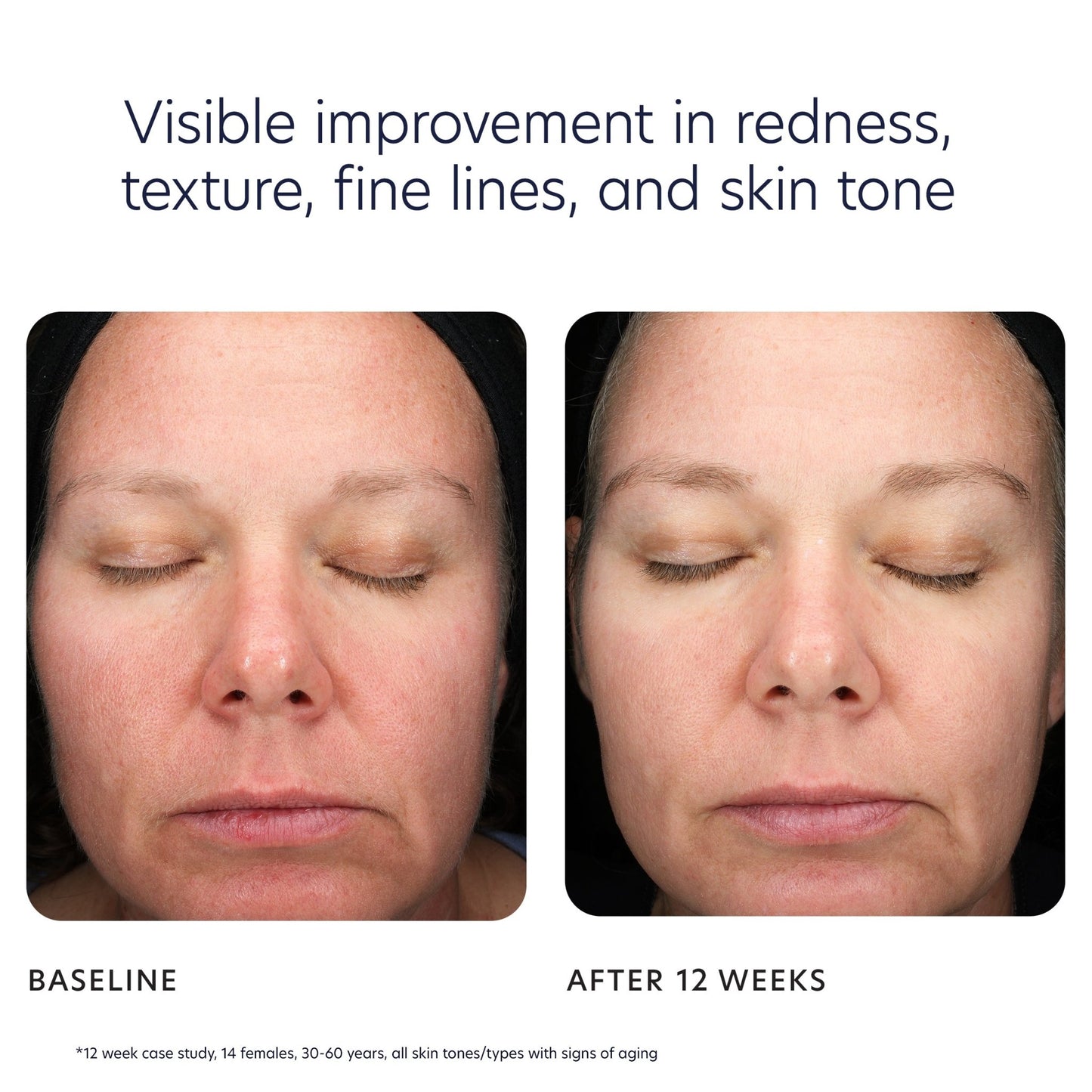 Triple Exfoliation Peel Pads - Beautifox