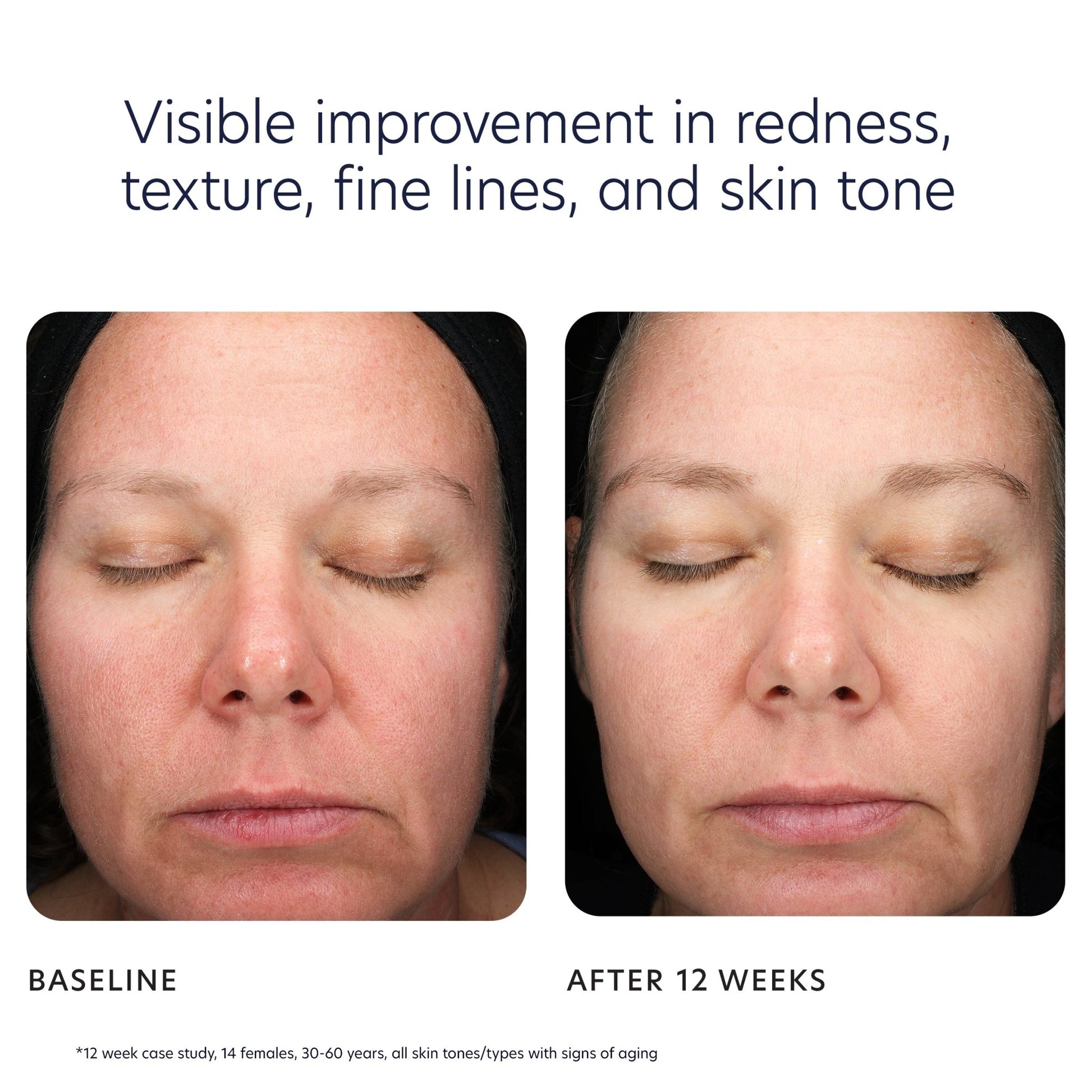 Triple Exfoliation Peel Pads - Beautifox