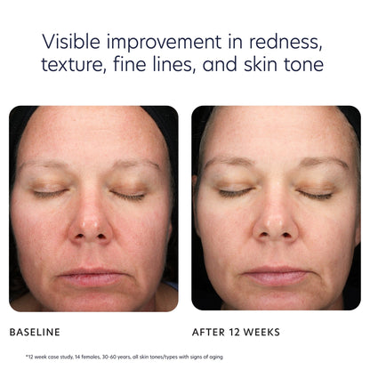 Triple Exfoliation Peel Pads - Beautifox