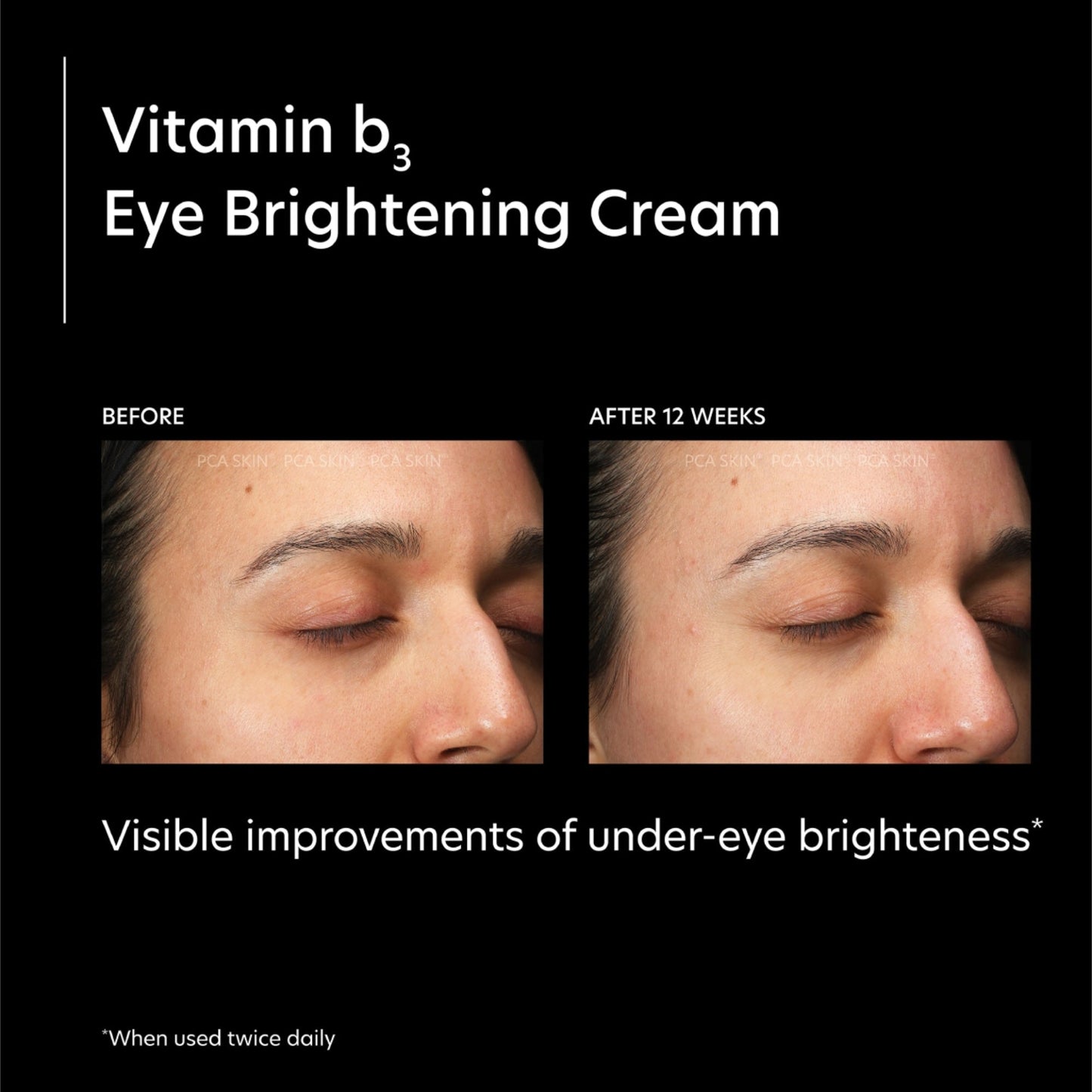 Vitamin b3 Eye Brightening Cream - Beautifox